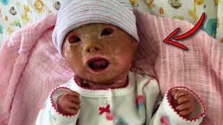 The Unbelievable Transformation of a 34-Week Preemie Baby - Prepare to Be Amazed