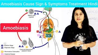 Amoebiasis Cause Symptoms Treatment in Hindi  What is Amoebiasis in Hindi  Entamoeba histolytica