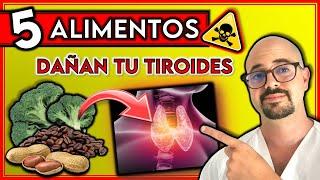 5 ALIMENTOS que debes EVITAR con HIPOTIROIDISMO  ¡Pueden DAÑAR tu TIROIDES