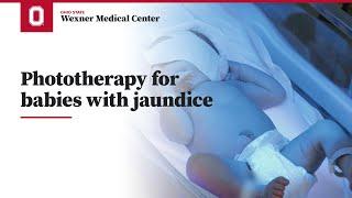 Phototherapy for babies with jaundice  Ohio State Medical Center