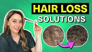 Hair Loss Treatments That Actually Work for Women & Men  Dr. Shereene Idriss