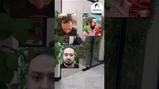 Medeks Hair Center review #hairtransplant #hairtransplantturkey #hairtransplantinturkey