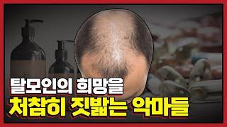 탈모 제품들은 탈모를 더 악화시키고 있다. 효과없음