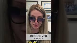 Voicefem - Before & After of Capris Voice Feminization Surgery