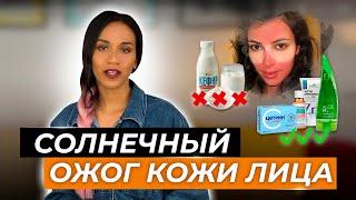 Солнечный ожог кожи лица как быть и что делать? Алгоритм действий при ожоге кожи лица