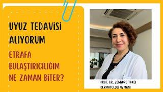 Uyuz tedavisi alıyorum etrafa bulaştırıcılığım ne zaman biter?