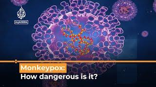 Monkeypox virus outbreak What’s happening?