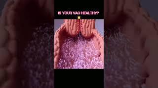 Is your vag.. healthy #shorts #education #mom