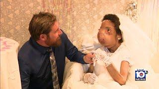 Woman with large tumor on face finds love marries longtime friend