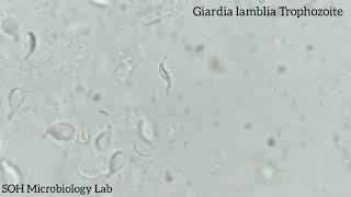 Giardia lamblia Trophozoite in stool