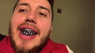 Bling Cartel Silver Shark Teeth Grillz Set review