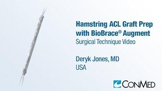 Dr. Deryk Jones - Hamstring ACL Graft Prep with BioBrace® Augment - CONMED Surgical Technique