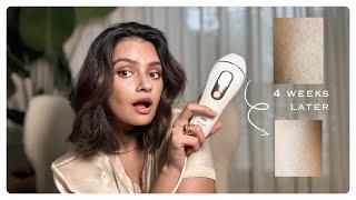 IPL Hair Removal At Home with Braun What I think 1.5 years later