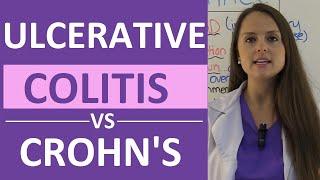 Crohns Disease vs Ulcerative Colitis Nursing  Crohns vs Colitis Chart Symptoms Treatment