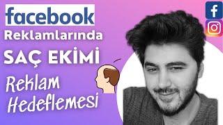 Saç ekim merkezleri için Facebook Meta reklam hedeflemesi  Sağlık Turizmi dijital pazarlama