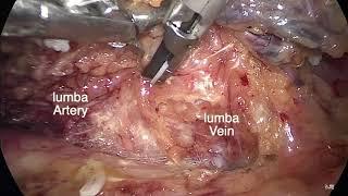 Lumba artery and vein