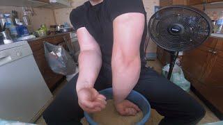 How I blew my forearms with rice update