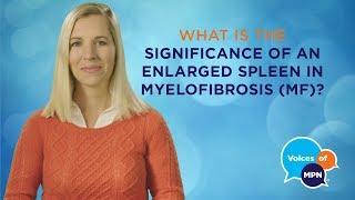 Why Is Spleen Size Important in Myelofibrosis?