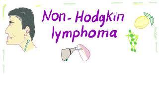 Non-Hodgkins lymphoma NHL B-cell and T-cell  Aggressive and Indolent