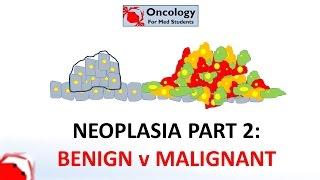 2. Neoplasia part 2 Differences between benign and malignant neoplasms