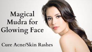 Magical Mudra for Glowing Face  Cure for Acne  Cure for Skin Rashes