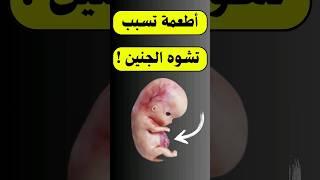 اطعمة قد تسبب تشوه الجنين  #الجنين #الحمل #حمل #حامل #جنين