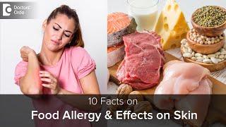 Food Allergy & how it affects SKIN  Causes Symptoms & Treatment-Dr.Rajdeep Mysore Doctors Circle