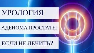 АДЕНОМА ПРОСТАТЫ - что будет если не лечить?