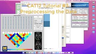 CAT12 Tutorial #3 Preprocessing