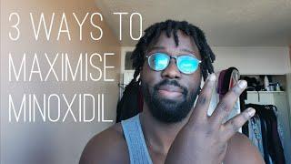 3 ways to maximise minoxidil gains for beard use