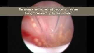 Laparoscopic-assisted removal of urinary bladder stones in dog