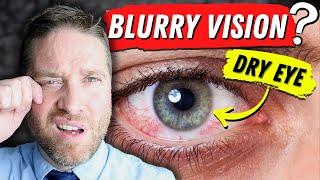 Why Dry Eyes Cause Blurry Vision - 3 Reasons And 3 Home Remedies