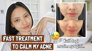 UPDATE NIGHT SKINCARE ROUTINE TERBARU DI KULIT BERJERAWAT  ⎮HOW I TREAT MY ACNE PRODUCTS + STEPS