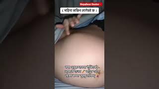 #नेपाल #research #pregnancycare #nepaldoctor #pregnancy #maya #doctornepal #nepalesedoctor ️