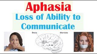 Aphasia  Types Broca’s Wernicke’s Global Causes Signs & Symptoms Diagnosis Treatment