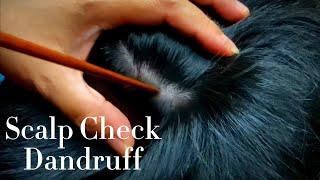 ASMR Scalp Check For Dandruff & Scalp Massage With scratching 