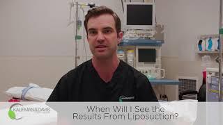 When Will I See Results from Liposuction?
