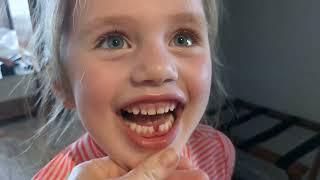 Zoe lost her 1st TOOTH  in Hawaii