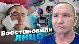 Лицо со шрамом - как татарстанские врачи восстановили внешний вид военного с СВО?