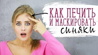 Как лечить и маскировать синяки Шпильки  Женский журнал