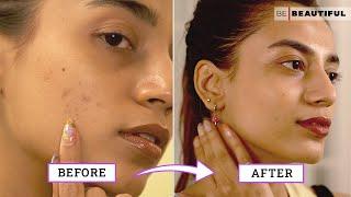 How To Improve Your Skin Texture  Skincare Tips For Bumpy Skin  Be Beautiful