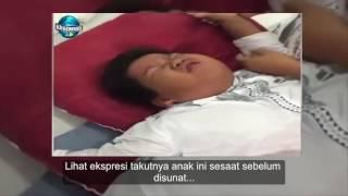 Saat mau di sunat anak ini pura2 pingsan bkin panik orng tuanya