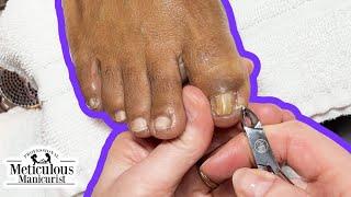 How to Fix Big Toenails & Pinky Nails Pedicure Tutorial