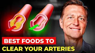 Dr. Eric Bergs SHOCKING Foods That Clean Your Arteries What Doctors Wont Tell You