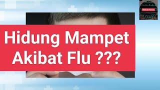 MEREDAKAN HIDUNG TERSUMBAT INFLUENZA