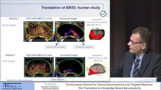 Latest Insights in Medical Imaging Based on Nanoparticles