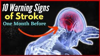 10 Stroke Symptoms that happen 1 month before Detect it Quickly