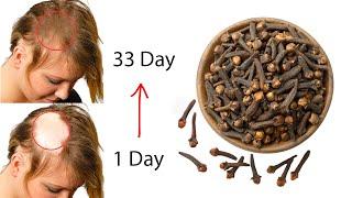 Starting from day 16 no more hair falls out You will be surprised by the results.