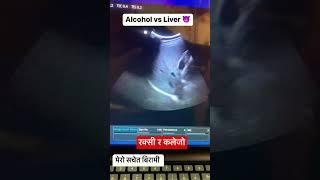 रक्सी र कलेजो Alcohol vs Liver #nepaldoctor #nepalesedoctor #नेपाल