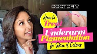 Doctor V - How To Treat Underarm pigmentation For Skin Of Colour  Brown Or Black Skin